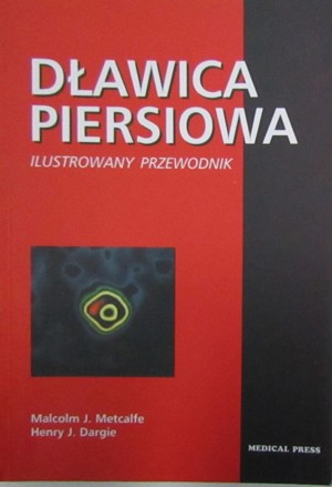 Dławica piersiowa. Ilustrowany przewodnik